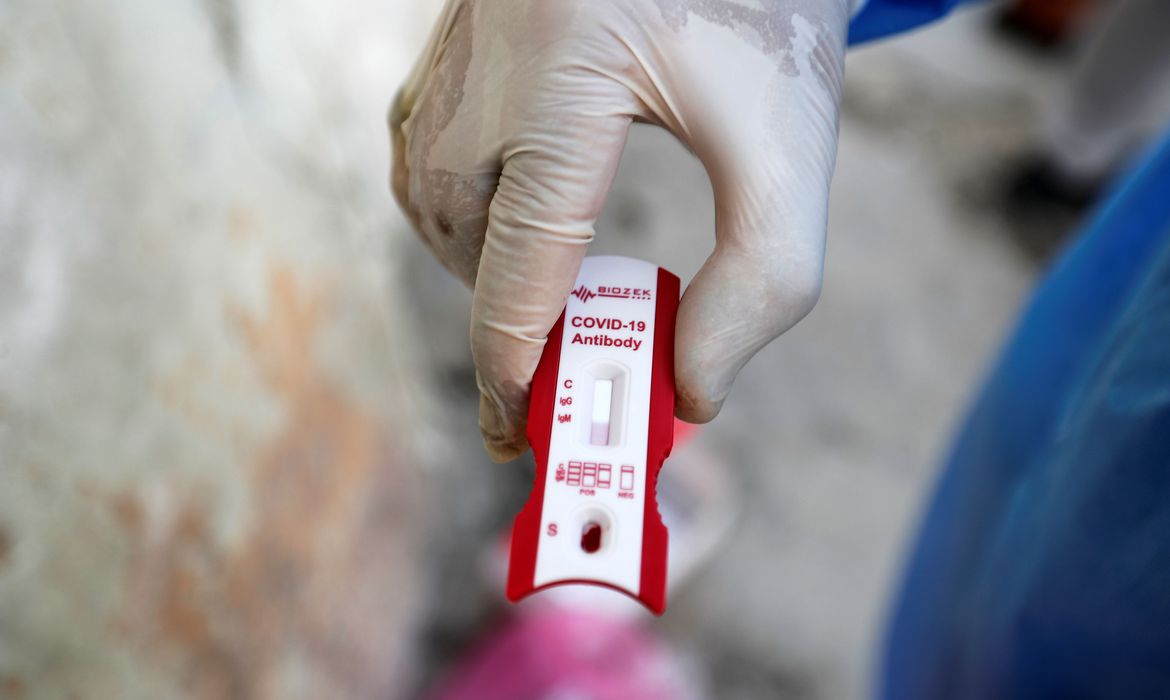 Pesquisa investiga relação entre genes e casos graves de covid-19